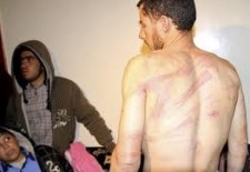 Torture In Syria Increasingly Brutal