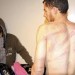 Torture In Syria Increasingly Brutal
