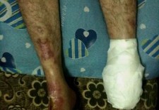 Suspected Collaborator Describes Torture