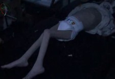 Activists in the Muaddamiyyah suburb of Damascus say that seven-year-old Duaa is suffering from malnutrition.Credit: YouTube.