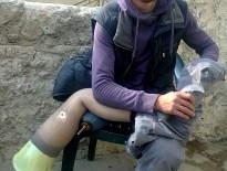 Nasser al-Qaddour considers himself lucky to have acquired a good prosthetic. Photograph: Mustafa al-Jalal