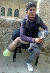 Nasser al-Qaddour considers himself lucky to have acquired a good prosthetic. Photograph: Mustafa al-Jalal
