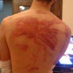 The back of one of Samih’s friends after he was whipped in the Palestine Branch.