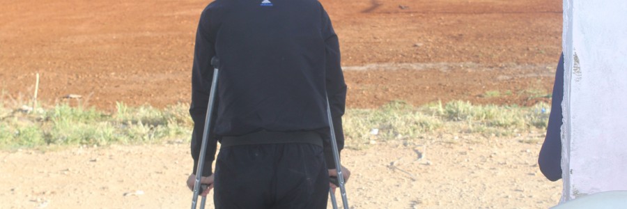 An guest whose leg had been amputated participates in the event